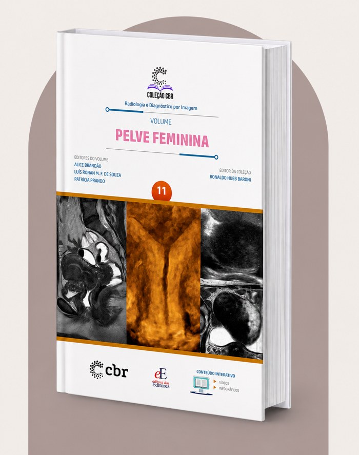 Livro Pelve Feminina - Coleção CBR